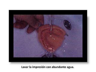 Lavar la impresión con abundante agua.

 