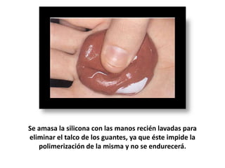 Se amasa la silicona con las manos recién lavadas para
eliminar el talco de los guantes, ya que éste impide la
polimerización de la misma y no se endurecerá.

 