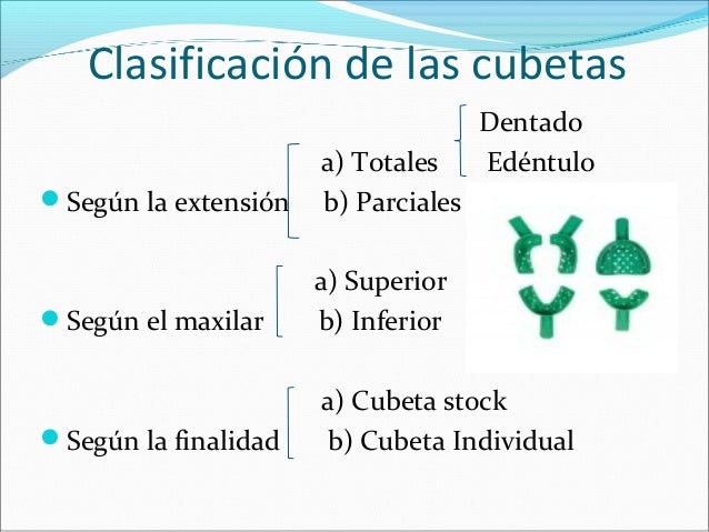 Que es una stock options