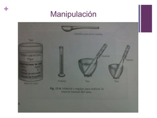 Manipulación