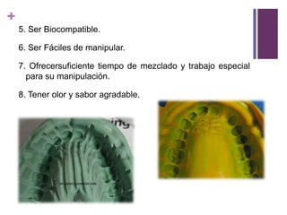 5. Ser Biocompatible.6. Ser Fáciles de manipular.7. Ofrecersuficientetiempo de mezclado y trabajo especial parasumanipulación.8. Tenerolor y saboragradable.