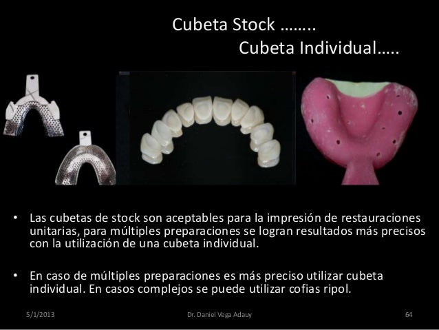 Que es una stock options