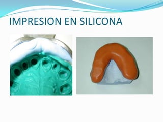 IMPRESION EN SILICONA