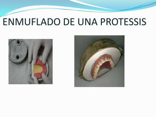 ENMUFLADO DE UNA PROTESSIS