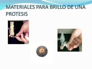 MATERIALES PARA BRILLO DE UNA PROTESIS