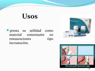 Usos
presta su utilidad como
material cementante en
restauraciones tipo
incrustación.
64
 