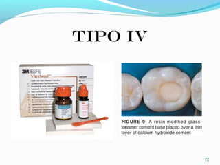 TIPO IV
72
 