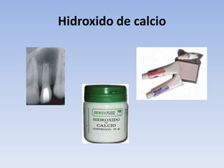 Hidroxido de calcio
 