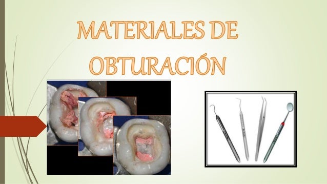 Materiales de obturacion