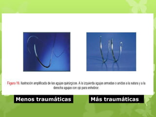Menos traumáticas Más traumáticas
 