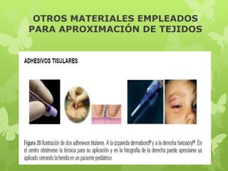 OTROS MATERIALES EMPLEADOS
PARA APROXIMACIÓN DE TEJIDOS
 