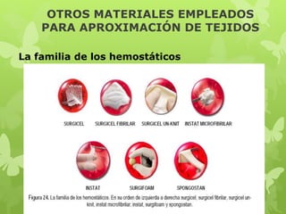 OTROS MATERIALES EMPLEADOS
PARA APROXIMACIÓN DE TEJIDOS
La familia de los hemostáticos
 
