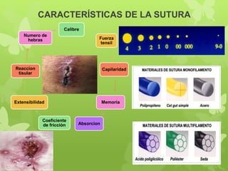 CARACTERÍSTICAS DE LA SUTURA
Calibre
Fuerza
tensil
Capilaridad
Memoria
Absorcion
Coeficiente
de fricción
Extensibilidad
Reaccion
tisular
Numero de
hebras
 