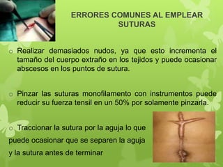 ERRORES COMUNES AL EMPLEAR
SUTURAS
o Realizar demasiados nudos, ya que esto incrementa el
tamaño del cuerpo extraño en los tejidos y puede ocasionar
abscesos en los puntos de sutura.
o Pinzar las suturas monofilamento con instrumentos puede
reducir su fuerza tensil en un 50% por solamente pinzarla.
o Traccionar la sutura por la aguja lo que
puede ocasionar que se separen la aguja
y la sutura antes de terminar
 