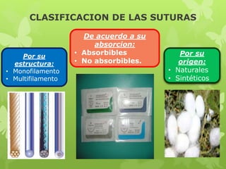 CLASIFICACION DE LAS SUTURAS
Por su
estructura:
• Monofilamento
• Multifilamento
Por su
origen:
• Naturales
• Sintéticos
De acuerdo a su
absorcion:
• Absorbibles
• No absorbibles.
 