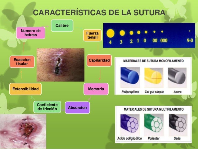 Materiales de Sutura