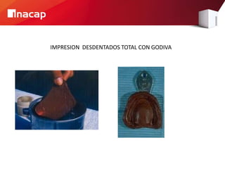 IMPRESION DESDENTADOS TOTAL CON GODIVA
 