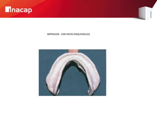 IMPRESION CON PASTA ZINQUENOLICA
 