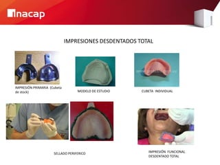 IMPRESIONES DESDENTADOS TOTAL
IMPRESIÓN PRIMARIA (Cubeta
de stock) CUBETA INDIVIDUAL
SELLADO PERIFERICO IMPRESIÓN FUNCIONAL
DESDENTADO TOTAL
MODELO DE ESTUDIO
 