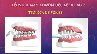 TÉCNICA MAS COMÚN DEL CEPILLADO
TÉCNICA DE FONES
 