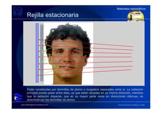 Materiales radiográficos
                                                                          Materiales radiográficos

      Rejilla estacionaria




      Están constituidas por laminillas de plomo o tungsteno separadas entre sí. La radiación
      principal puede pasar entre ellas, ya que están situadas en su misma dirección, mientras
      que la radiación dispersa, que en su mayor parte viene en direcciones oblicuas, es
      absorbida por las laminillas de plomo.
www.radiologiaoral.wordpress.com                                           Derechos Reservados © 2009 por A. Padilla
 