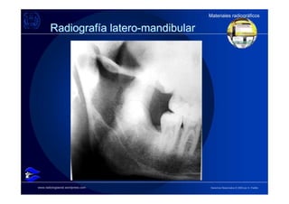 Materiales radiográficos
                                        Materiales radiográficos

        Radiografía latero-mandibular




www.radiologiaoral.wordpress.com        Derechos Reservados © 2009 por A. Padilla
 