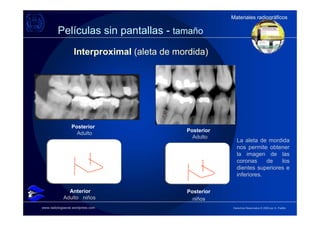 Materiales radiográficos
                                                         Materiales radiográficos

         Películas sin pantallas - tamaño
                   Interproximal (aleta de mordida)




                 Posterior
                                             Posterior
                   Adulto
                                               Adulto
                                                           La aleta de mordida
                                                           nos permite obtener
                                                           la imagen de las
                                                           coronas     de   los
                                                           dientes superiores e
                                                           inferiores.

              Anterior                       Posterior
            Adulto niños                       niños
www.radiologiaoral.wordpress.com                         Derechos Reservados © 2009 por A. Padilla
 