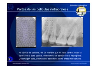Materiales radiográficos
                                                                 Materiales radiográficos

        Partes de las películas (Intraorales)




            Al colocar la película, de tal manera que el rayo central incide a
            través de la cara pasiva, obtenemos un defecto en la radiografía.
            Una imagen clara, además del diseño del plomo antes mencionado.

www.radiologiaoral.wordpress.com                                  Derechos Reservados © 2009 por A. Padilla
 