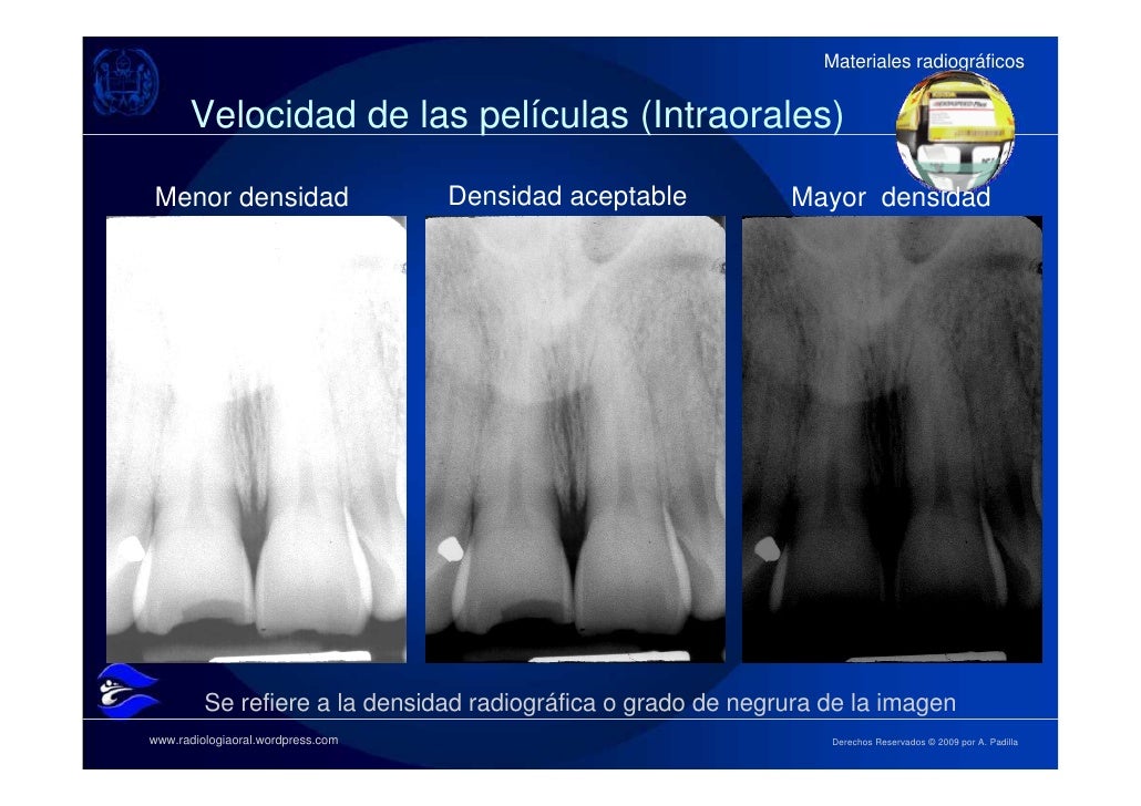 Resultado de imagen para densidades radiologicas y contraste dental
