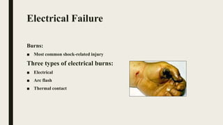 Electrical Failure
Burns:
■ Most common shock-related injury
Three types of electrical burns:
■ Electrical
■ Arc flash
■ Thermal contact
 
