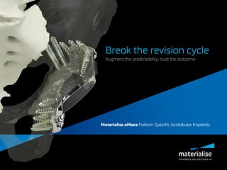 Materialise aMace Patient-Specific Acetabular Implants
Break the revision cycle
Augment the predictability, trust the outcome
 