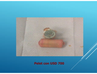 Pelet con USD 700
 