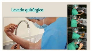 Lavado quirúrgico 
 