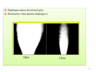  Diaphragm reduces the internal glare
 Illumination, when aperture diaphragm is
Open Close
43
 