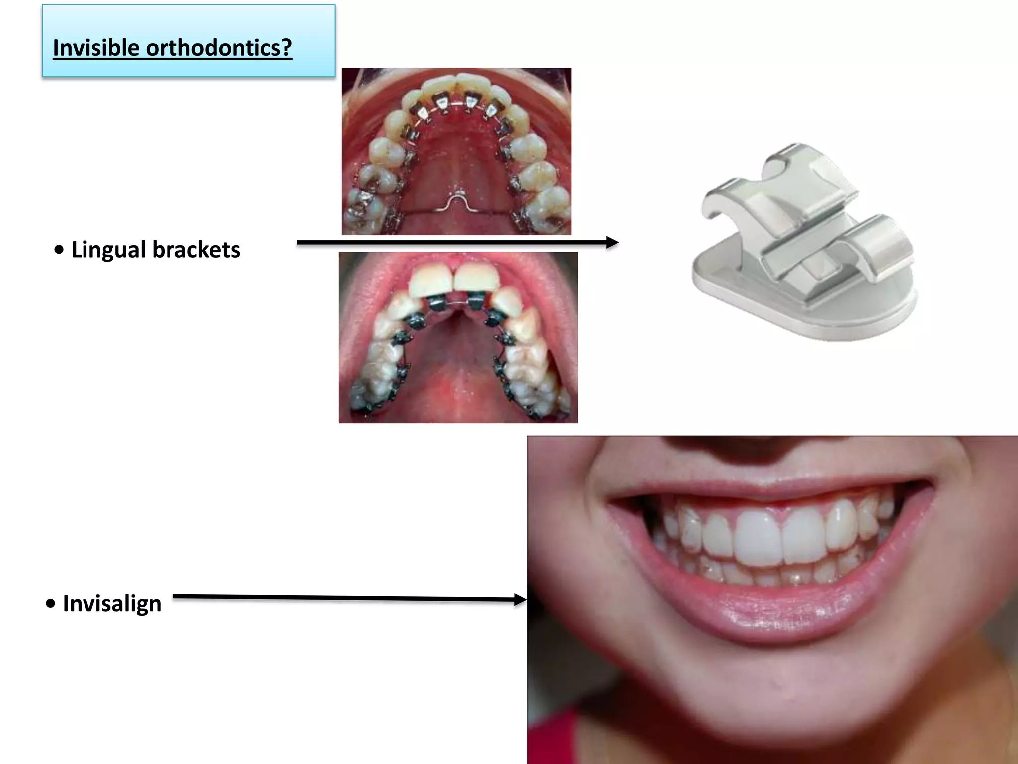 Materials used in Orthodontics _ Dr. Nabil Al-Zubair | PDF