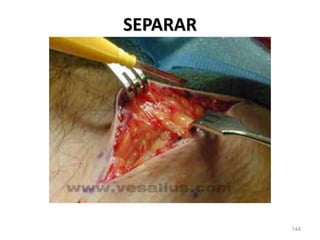 144
SEPARAR
 