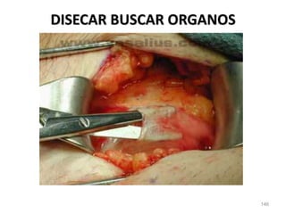 146
DISECAR BUSCAR ORGANOS
 