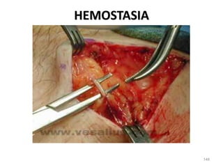 148
HEMOSTASIA
 