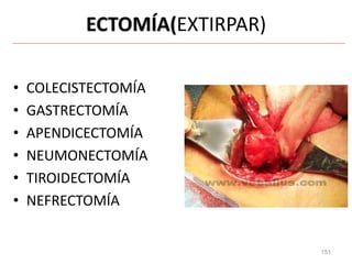 151
ECTOMÍA(EXTIRPAR)
• COLECISTECTOMÍA
• GASTRECTOMÍA
• APENDICECTOMÍA
• NEUMONECTOMÍA
• TIROIDECTOMÍA
• NEFRECTOMÍA
 
