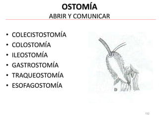 152
OSTOMÍA
ABRIR Y COMUNICAR
• COLECISTOSTOMÍA
• COLOSTOMÍA
• ILEOSTOMÍA
• GASTROSTOMÍA
• TRAQUEOSTOMÍA
• ESOFAGOSTOMÍA
 