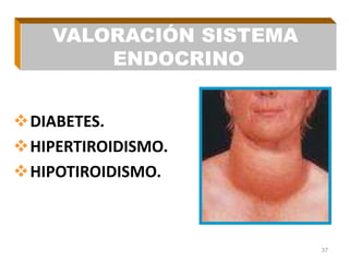 DIABETES.
HIPERTIROIDISMO.
HIPOTIROIDISMO.
37
VALORACIÓN SISTEMA
ENDOCRINO
 