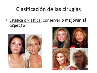Clasificación de las cirugías
• Estética o Plástica: Conservar o mejorar el
aspecto
7
 