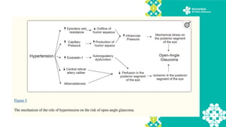 Materi dr. Resy R-Hipertensi-DM-Glaukoma.pptx