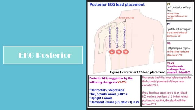 MATERI EKG DASAR - Ratih.pptx