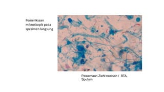 Pewarnaan Ziehl neelsen / BTA,
Sputum
Pemeriksaan
mikroskopik pada
spesimen langsung
 