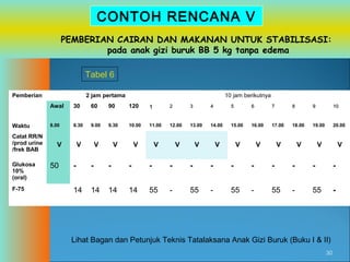 CONTOH RENCANA V
PEMBERIAN CAIRAN DAN MAKANAN UNTUK STABILISASI:
pada anak gizi buruk BB 5 kg tanpa edema
Tabel 6
Pemberian

2 jam pertama

10 jam berikutnya

Awal
Waktu
Catat RR/N
/prod urine
/frek BAB
Glukosa
10%
(oral)
F-75

30

60

90

120

1

2

3

4

5

6

7

8

9

10

8.00

8.30

9.00

9.30

10.00

11.00

12.00

13.00

14.00

15.00

16.00

17.00

18.00

19.00

20.00

V

V

V

V

V

V

V

V

V

V

V

V

V

50

V

V

-

-

-

-

-

-

-

-

-

-

-

-

-

-

14

14

14

14

55

-

55

-

55

-

55

-

55

-

Lihat Bagan dan Petunjuk Teknis Tatalaksana Anak Gizi Buruk (Buku I & II)
30

 