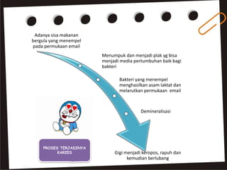 Adanya sisa makanan
bergula yang menempel
pada permukaan email
Menumpuk dan menjadi plak yg bisa
menjadi media pertumbuhan baik bagi
bakteri
Bakteri yang menempel
menghasilkan asam laktat dan
melarutkan permukaan email
Demineralisasi
Gigi menjadi keropos, rapuh dan
kemudian berlubang
PROSES TERJADINYA
KARIES
 