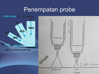 Penempatan probe 
20 
 