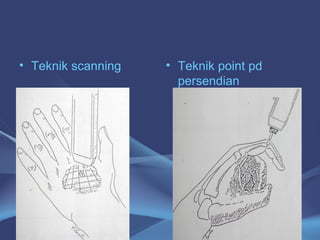 • Teknik scanning • Teknik point pd 
persendian 
21 
 