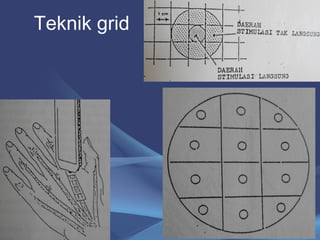 Teknik grid 
22 
 